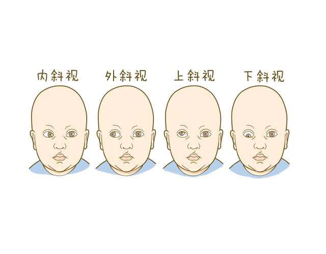 怎么確定小孩屬于哪種類型的腦癱?小孩有腦癱飲食上注意什么?