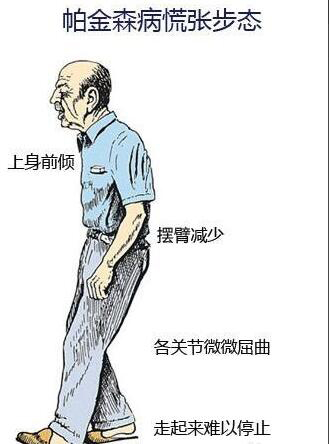 經顱磁刺激問題詳解|帕金森病人的家庭護理 