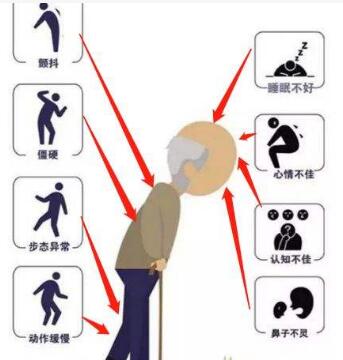 經(jīng)顱磁刺激常見問題_帕金森病怎樣康復(fù)訓(xùn)練最好 